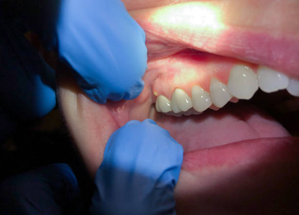 Best 24-Hour Emergency Dentist in Forest Hill, TX
