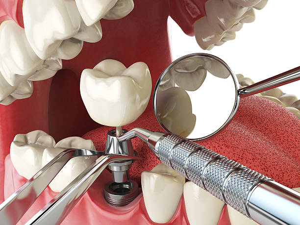 Best Same-Day Emergency Dental Services in Forest Hill, TX